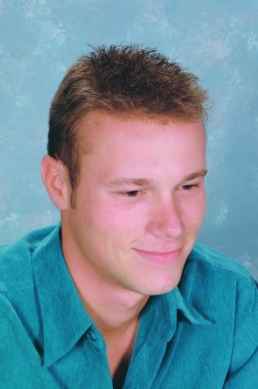 אחרי מילוי מפרצים ושיער דליל