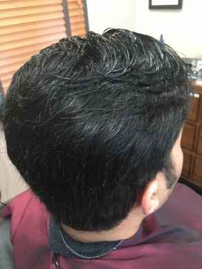 אחרי מילוי שיער דליל במיוחד