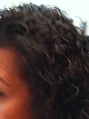 אחרי השלמת קרחת במרכז הקרקפת