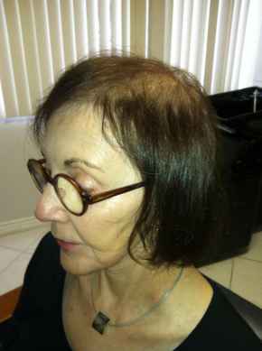 לפני השלמת שיער